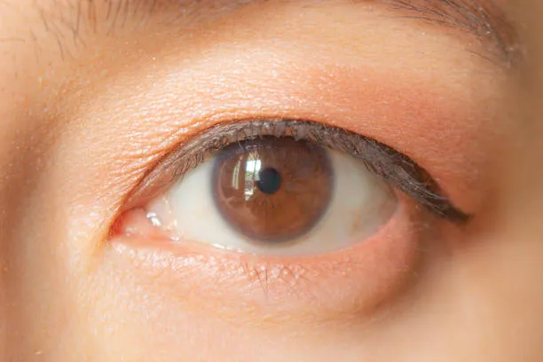 info-612-408 info-612-408